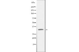 Western blot analysis of extracts from Jurkat cells, using AQP12 antibody. (Aquaporin 12A anticorps  (C-Term))