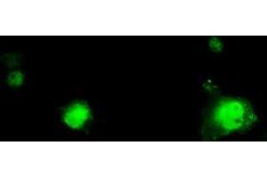 Image no. 1 for anti-Replication Protein A2, 32kDa (RPA2) antibody (ABIN1500739) (RPA2 anticorps)