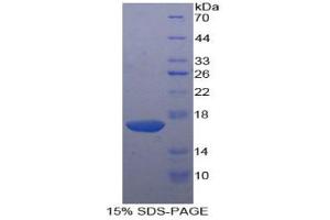 SDS-PAGE analysis of Human KLRB1 Protein. (CD161 Protéine)