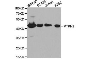 Western blot analysis of extracts of various cell lines, using PTPN2 antibody. (PTPN2 anticorps  (AA 1-353))