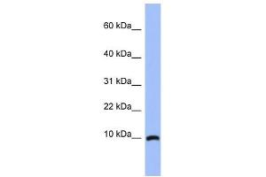 ACBD7 antibody used at 1 ug/ml to detect target protein. (ACBD7 anticorps  (N-Term))