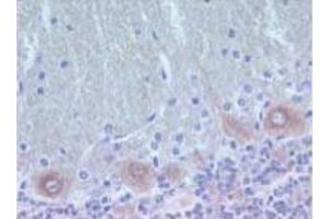 Rat brain zinc-fixed paraffin-embedded tissue (PKC delta anticorps  (AA 114-289))