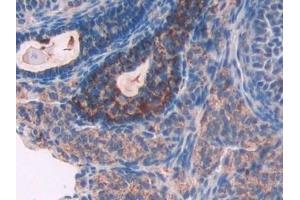 Detection of TPP1 in Mouse Ovary Tissue using Polyclonal Antibody to Tripeptidyl Peptidase I (TPP1)