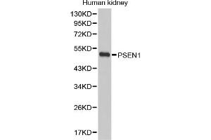 Western blot analysis of extracts of human kidney, using PSEN1 antibody (ABIN5971213). (Presenilin 1 anticorps)