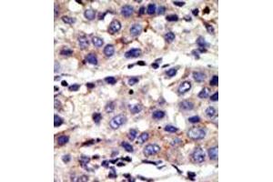 Image no. 2 for anti-Chromobox Homolog 4 (CBX4) (N-Term) antibody (ABIN357750) (CBX4 anticorps  (N-Term))