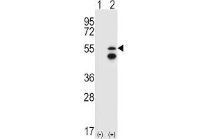 Western Blotting (WB) image for anti-Fyn-Related Kinase (FRK) antibody (ABIN3003444) (FRK anticorps)