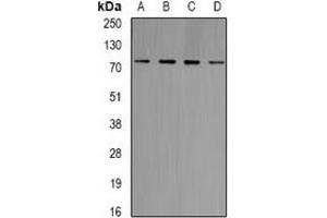 Western blot analysis of GlyRS expression in Jurkat (A), Raji (B), HT29 (C), mouse brain (D) whole cell lysates. (GlyRS anticorps)