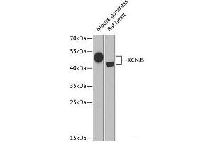 Western blot analysis of extracts of various cell lines using KCNJ5 Polyclonal Antibody at dilution of 1:1000. (KCNJ5 anticorps)