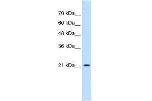WB Suggested Anti-PGRMC1 Antibody Titration:  0. (PGRMC1 anticorps  (N-Term))