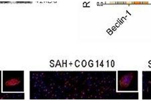 Effect of p-GSK-3β to the COG1410 promoted neuron autophagy.