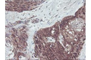 Image no. 1 for anti-Interferon Regulatory Factor 6 (IRF6) antibody (ABIN1498901)