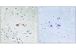 Immunohistochemistry analysis of paraffin-embedded human brain tissue, using FKHR (Ab-256) Antibody. (FOXO1 anticorps  (AA 223-272))