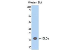 Western Blotting (WB) image for anti-Fascin (FSCN1) (AA 277-396) antibody (ABIN1858919)