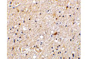 Immunohistochemistry (IHC) image for anti-Nerve Growth Factor Receptor (TNFRSF16) Associated Protein 1 (NGFRAP1) (Middle Region) antibody (ABIN1031007)