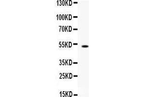 Western blot analysis of FCGRT using anti-FCGRT antibody (ABIN3044522).
