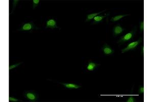 Immunofluorescence of monoclonal antibody to HNF4A on HeLa cell. (HNF4A anticorps  (AA 324-423))