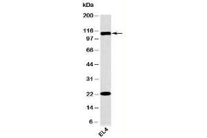 Western blot testing of mouse samples with TLR9 antibody at 2ug/ml. (TLR9 anticorps  (N-Term))