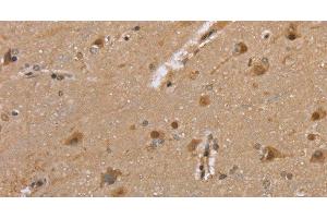 Immunohistochemistry of paraffin-embedded Human brain tissue using DLD Polyclonal Antibody at dilution 1:35