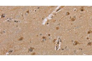 Immunohistochemistry of paraffin-embedded Human brain tissue using DLD Polyclonal Antibody at dilution 1:35 (DLD anticorps)