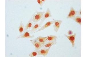 Immunocytochemistry analysis of ABIN7127684 diluted at 1:80 and staining in Hela cells(treated with Pervanadate) performed on a Leica BondTM system.