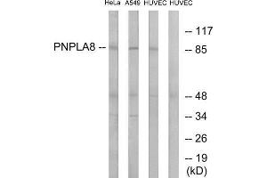 Western Blotting (WB) image for anti-Patatin-Like phospholipase Domain Containing 8 (PNPLA8) (C-Term) antibody (ABIN1850962) (PNPLA8 anticorps  (C-Term))