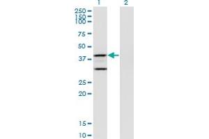 Western Blot analysis of PTGES2 expression in transfected 293T cell line by PTGES2 monoclonal antibody (M01), clone 5B7.