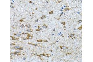 Immunohistochemistry of paraffin-embedded Mouse spinal cord using PDP1 Polyclonal Antibody at dilution of 1:100 (40x lens). (PDP anticorps)