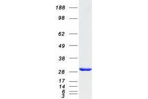 Validation with Western Blot