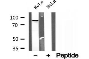 Western blot analysis of extracts of HeLa cells, using OSBP antibody. (OSBP anticorps  (Internal Region))