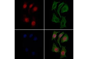 ABIN6265173 and ABIN6269300 staining Hela cells by IF/ICC. (SMAD3 anticorps  (C-Term))