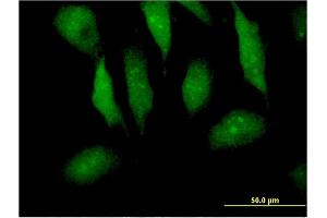Immunofluorescence of monoclonal antibody to MTPN on HeLa cell. (MTPN anticorps  (AA 1-118))