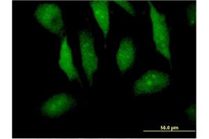 Immunofluorescence of monoclonal antibody to MTPN on HeLa cell. (MTPN anticorps  (AA 1-118))