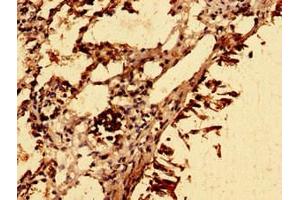 Immunohistochemistry of paraffin-embedded human lung tissue using ABIN7176714 at dilution of 1:100 (SLC39A8 anticorps  (AA 30-132))