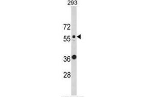 Western blot analysis of KRT10 Antibody (N-term) in 293 cell line lysates (35ug/lane). (Keratin 10 anticorps  (N-Term))