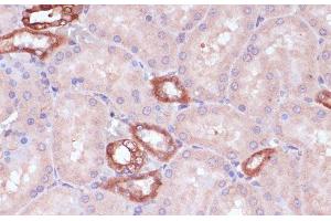 Immunohistochemistry of paraffin-embedded Rat kidney using UGT2B15 Polyclonal Antibody at dilution of 1:100 (40x lens). (UGT2B15 anticorps)