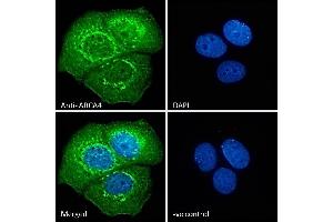 ABIN343052 Immunofluorescence analysis of paraformaldehyde fixed MCF7 cells, permeabilized with 0. (ABCA4 anticorps  (AA 2250-2263))
