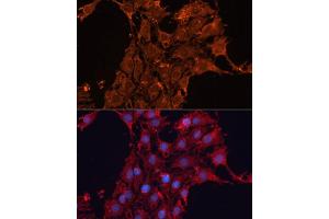 Immunofluorescence analysis of C6 cells using  antibody (ABIN6131156, ABIN6136521, ABIN6136522 and ABIN6223942) at dilution of 1:100. (ADAM12 anticorps  (AA 589-738))