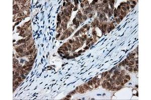 Immunohistochemical staining of paraffin-embedded Kidney tissue using anti-FAHD2A mouse monoclonal antibody. (FAHD2A anticorps)