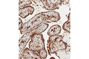 Immunohistochemical analysis of paraffin-embedded Human placenta tissue using (ABIN656475 and ABIN2845755) performed on the Leica® BOND RXm. (GAA anticorps  (N-Term))