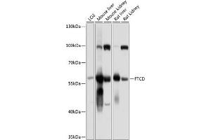 Western blot analysis of extracts of various cell lines, using FTCD antibody (ABIN6133518, ABIN6140789, ABIN6140790 and ABIN6225015) at 1:1000 dilution. (FTCD anticorps  (AA 412-541))