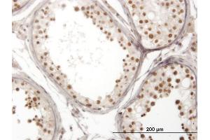 Immunoperoxidase of monoclonal antibody to NOL4 on formalin-fixed paraffin-embedded human testis. (NOL4 anticorps  (AA 425-524))