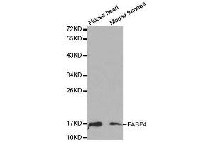 Western blot analysis of extracts of various cell lines, using FABP4 antibody.