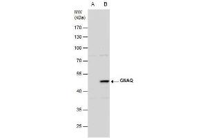 WB Image GNAQ antibody detects GNAQ protein by western blot analysis.