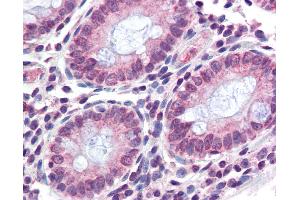 Anti-TMPRSS4 antibody IHC of human colon.