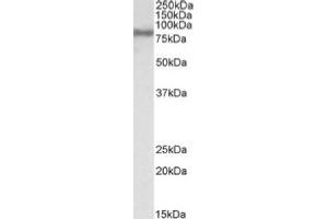 Image no. 1 for anti-Acyl-CoA Synthetase Long-Chain Family Member 4 (ACSL4) (C-Term) antibody (ABIN487992) (ACSL4 anticorps  (C-Term))