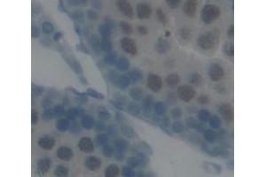 IHC-P analysis of Human Tissue, with DAB staining. (PIAS1 anticorps  (AA 409-645))