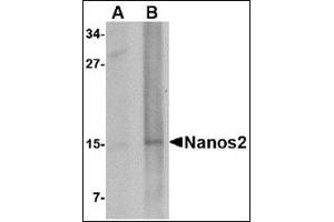 Western blot analysis of Nanos2 in rat brain tissue lysate with this product at (A) 1 and (B) 2 μg/ml. (NANOS2 anticorps  (N-Term))