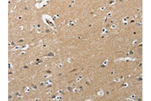 The image on the left is immunohistochemistry of paraffin-embedded Human brain tissue using ABIN7191891(PIP5K1C Antibody) at dilution 1/25, on the right is treated with synthetic peptide. (PIP5K1C anticorps)