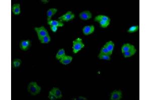 Immunofluorescence staining of HepG2 cells with ABIN7142996 at 1:133, counter-stained with DAPI.
