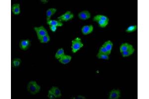 Immunofluorescence staining of HepG2 cells with ABIN7142996 at 1:133, counter-stained with DAPI. (ASIC1 anticorps  (AA 195-297))